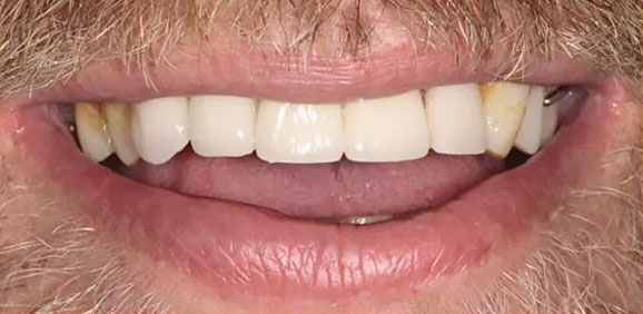 Sunset Family Dentistry Sunset Family Dentistry