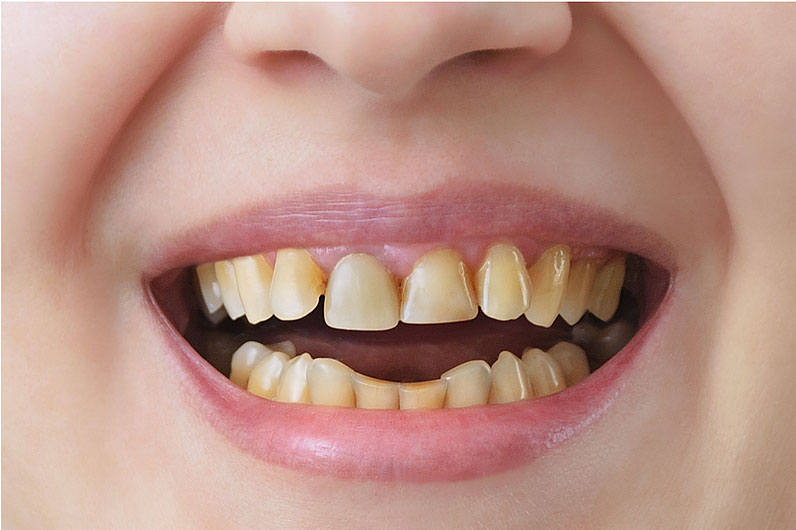 Sunset Family Dentistry Sunset Family Dentistry