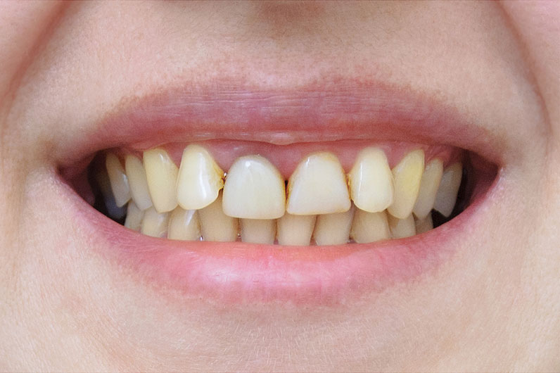 Sunset Family Dentistry Sunset Family Dentistry