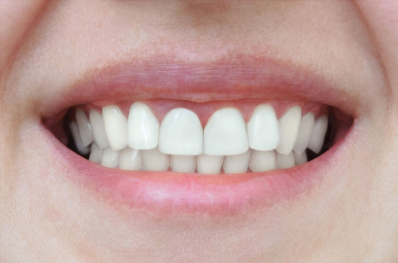 Sunset Family Dentistry Sunset Family Dentistry