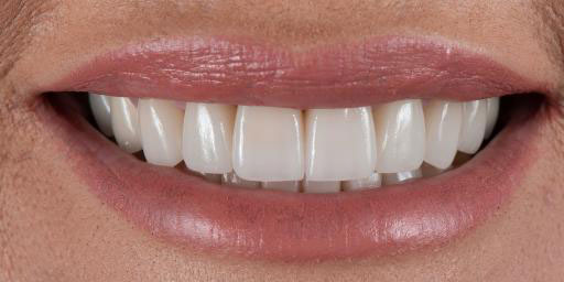 Sunset Family Dentistry Sunset Family Dentistry